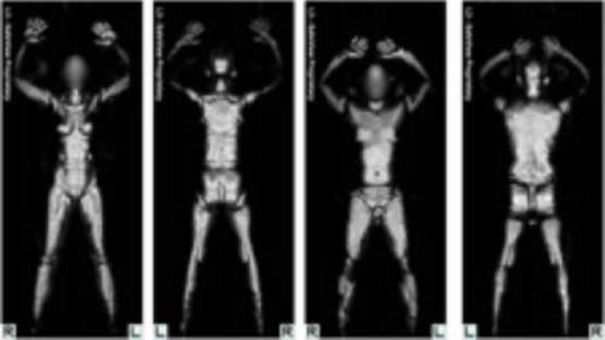 PI statement on proposed deployment of body scanners in airports